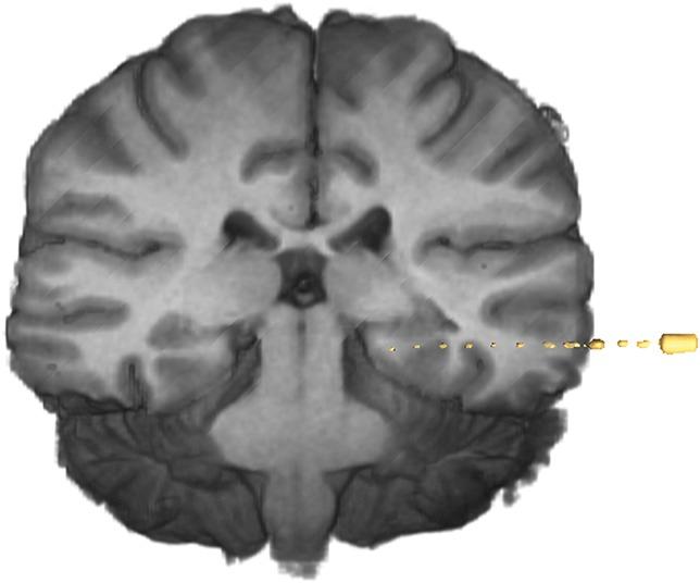 https://cdn.ncbi.nlm.nih.gov/pmc/blobs/01d1/4224568/0152064e60c2/neu-10-525-g014.jpg