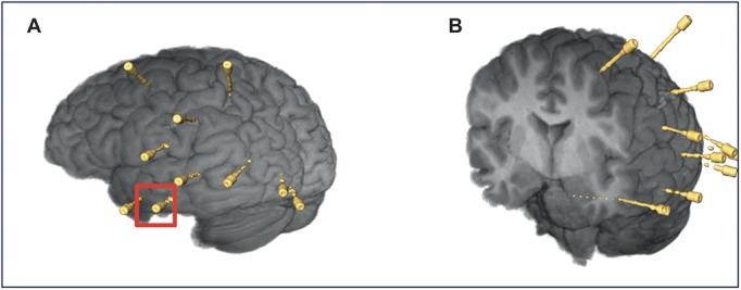 https://cdn.ncbi.nlm.nih.gov/pmc/blobs/01d1/4224568/3920082572d0/neu-10-525-g004.jpg