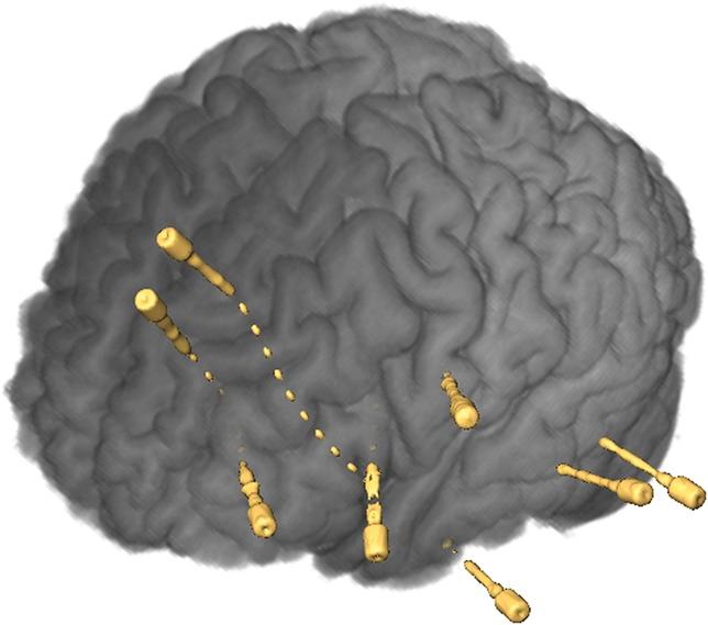 https://cdn.ncbi.nlm.nih.gov/pmc/blobs/01d1/4224568/5f08ec77009a/neu-10-525-g015.jpg