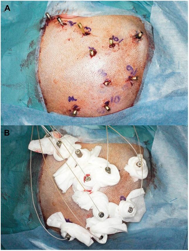 https://cdn.ncbi.nlm.nih.gov/pmc/blobs/01d1/4224568/7db3d0f4a6b9/neu-10-525-g003.jpg