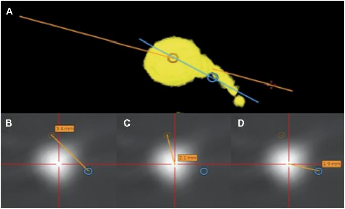 https://cdn.ncbi.nlm.nih.gov/pmc/blobs/01d1/4224568/88924451afb2/neu-10-525-g006.jpg