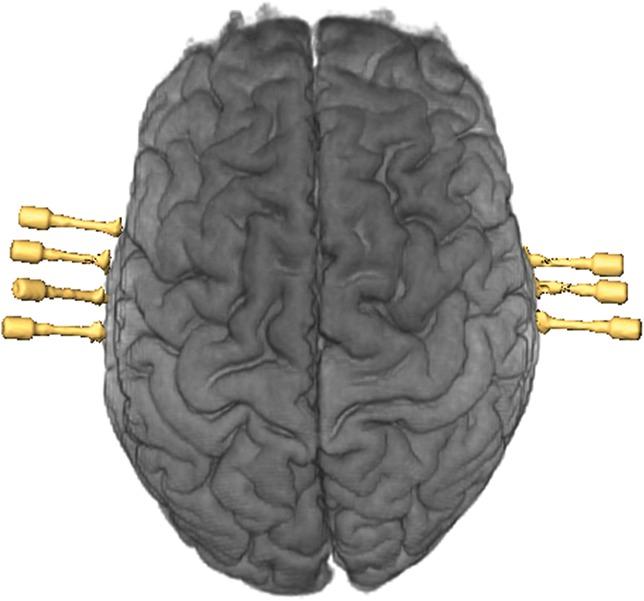 https://cdn.ncbi.nlm.nih.gov/pmc/blobs/01d1/4224568/b89dd582b679/neu-10-525-g010.jpg