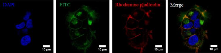 https://cdn.ncbi.nlm.nih.gov/pmc/blobs/01d2/7548234/08688f8f121e/IJN-15-7569-g0003.jpg