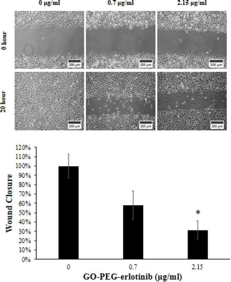 https://cdn.ncbi.nlm.nih.gov/pmc/blobs/01d2/7548234/38844d579088/IJN-15-7569-g0005.jpg