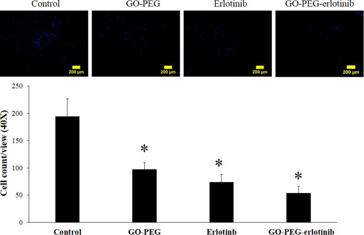 https://cdn.ncbi.nlm.nih.gov/pmc/blobs/01d2/7548234/ff9494a3ff86/IJN-15-7569-g0006.jpg