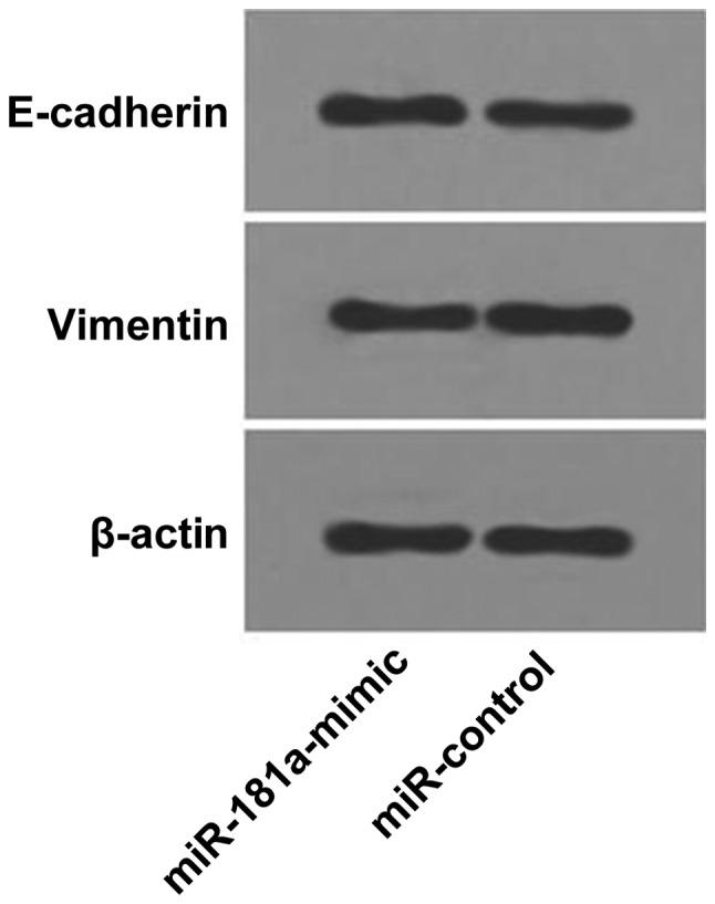 https://cdn.ncbi.nlm.nih.gov/pmc/blobs/01d6/6489007/392c060daa22/etm-17-06-4435-g08.jpg