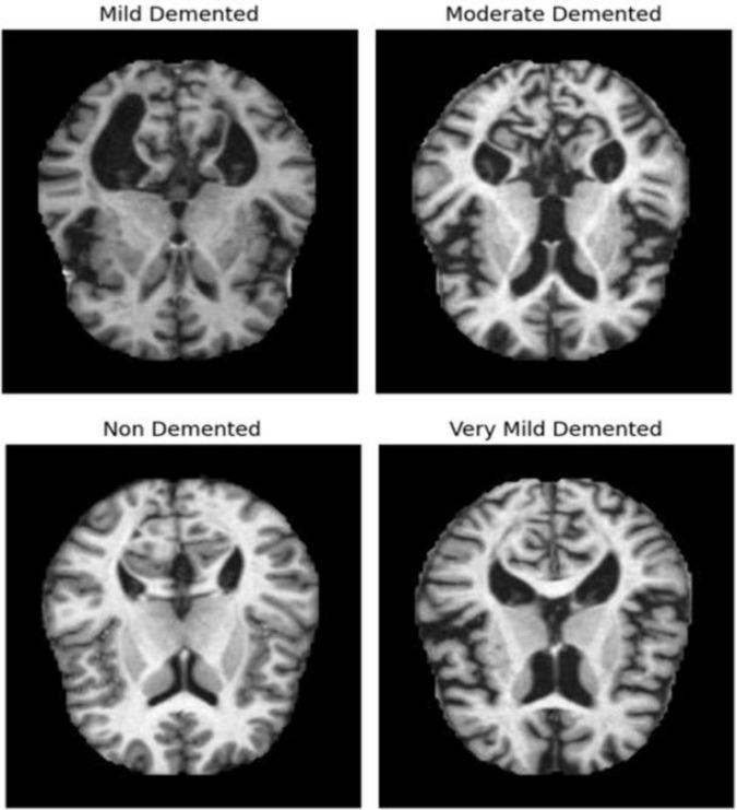 https://cdn.ncbi.nlm.nih.gov/pmc/blobs/01dd/11525984/eec00ace95cc/fncom-18-1444019-g001.jpg