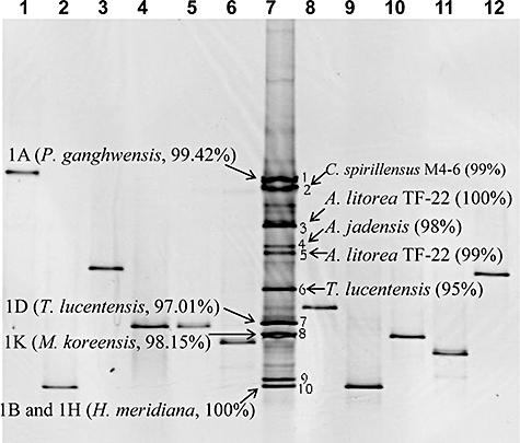 https://cdn.ncbi.nlm.nih.gov/pmc/blobs/01de/2702504/1a7e7e2fa8f5/emi0010-2138-f2.jpg