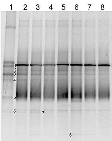 https://cdn.ncbi.nlm.nih.gov/pmc/blobs/01de/2702504/b896a16fb792/emi0010-2138-f6.jpg