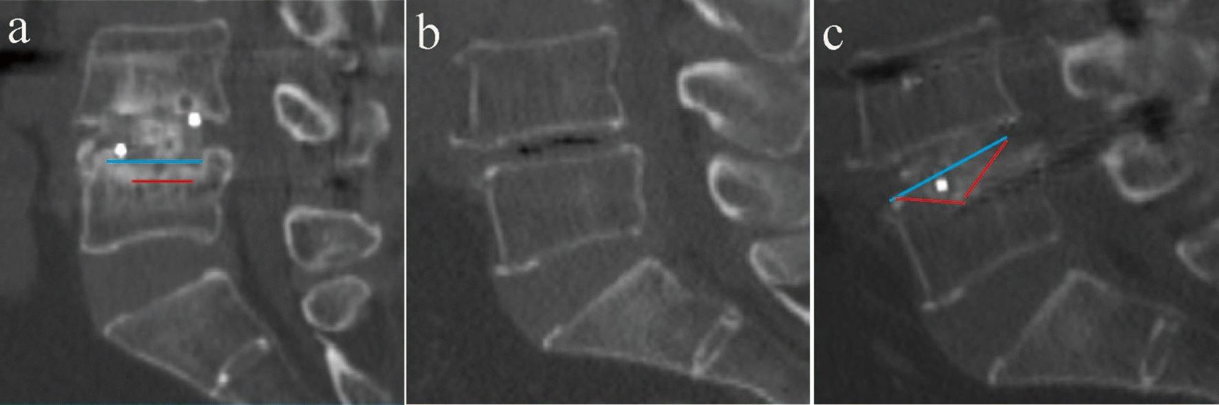https://cdn.ncbi.nlm.nih.gov/pmc/blobs/01df/12210715/5d0e899da3f5/40001_2025_2797_Fig3_HTML.jpg