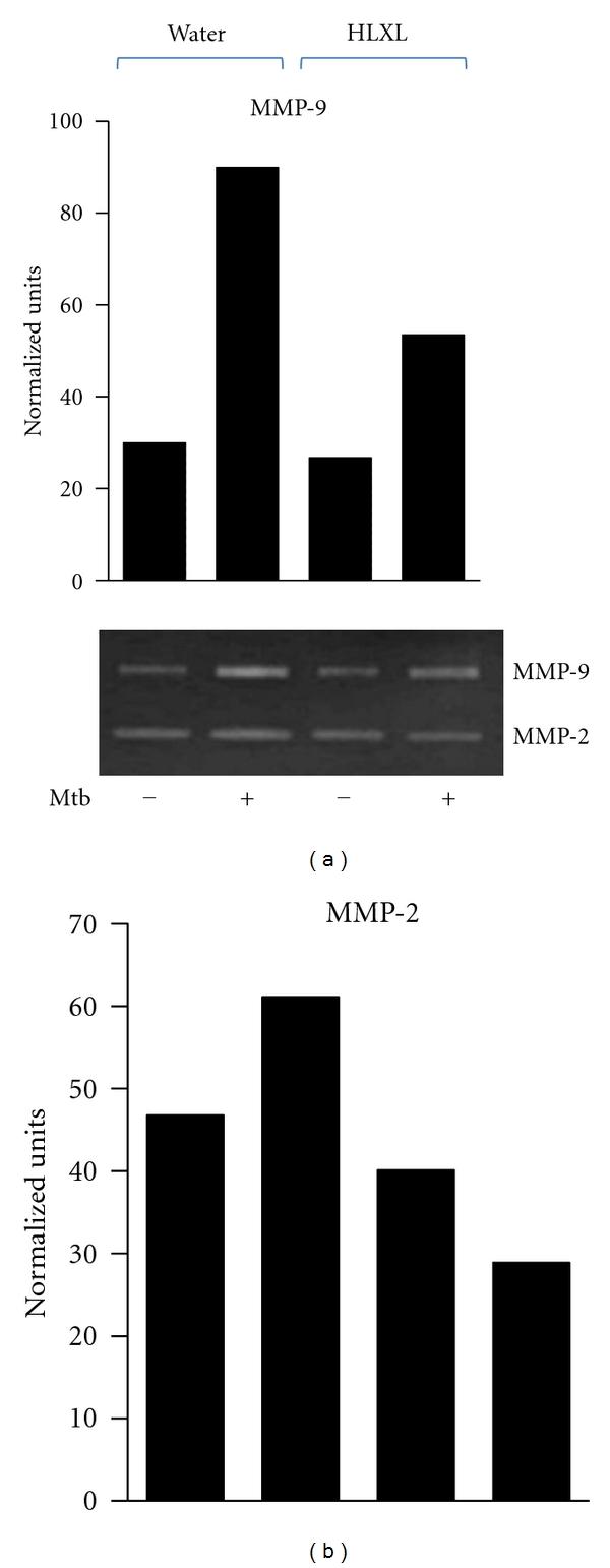 https://cdn.ncbi.nlm.nih.gov/pmc/blobs/01e6/3310235/f5247ce61377/ECAM2012-589256.002.jpg