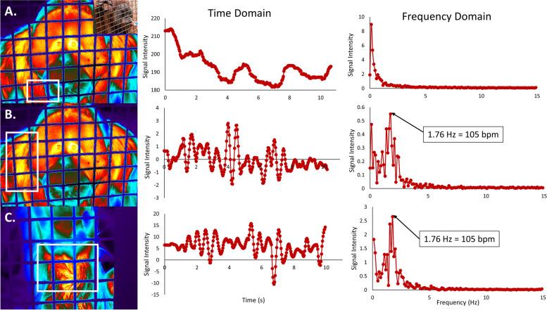 https://cdn.ncbi.nlm.nih.gov/pmc/blobs/01ea/10052854/c8bddd808f38/12915_2023_1555_Fig2_HTML.jpg