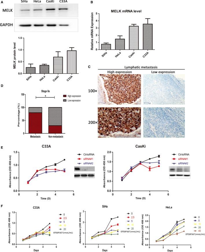 https://cdn.ncbi.nlm.nih.gov/pmc/blobs/01eb/6246930/63e58716f19c/CAM4-7-5665-g003.jpg