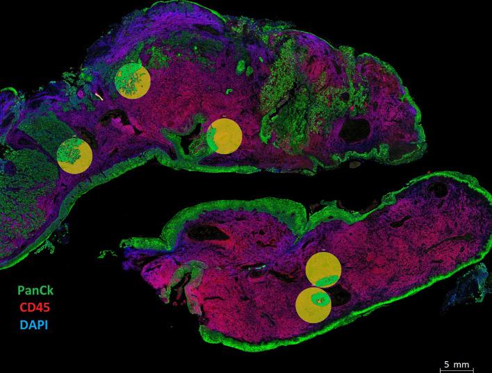 https://cdn.ncbi.nlm.nih.gov/pmc/blobs/01ee/10154785/2c12fe1d676f/fimmu-14-1135489-g002.jpg