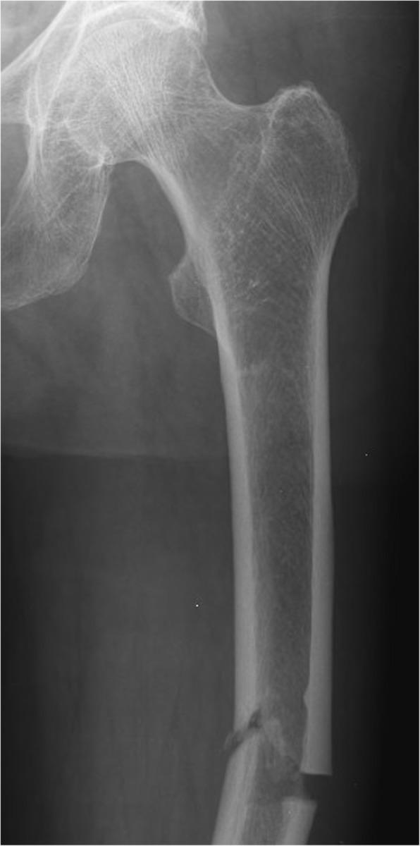 https://cdn.ncbi.nlm.nih.gov/pmc/blobs/01f0/7493328/b962cf532268/13018_2020_1941_Fig1_HTML.jpg