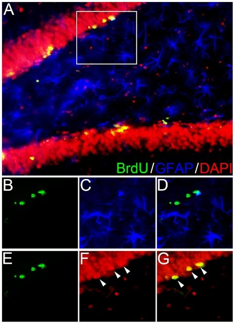 https://cdn.ncbi.nlm.nih.gov/pmc/blobs/01f1/2995744/6d97d8dc050f/pone.0015267.g002.jpg