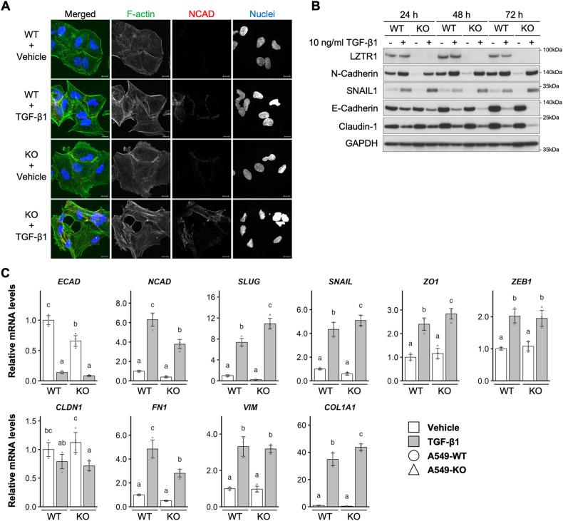 https://cdn.ncbi.nlm.nih.gov/pmc/blobs/01f7/10457367/d242b55a8947/41419_2023_6072_Fig4_HTML.jpg