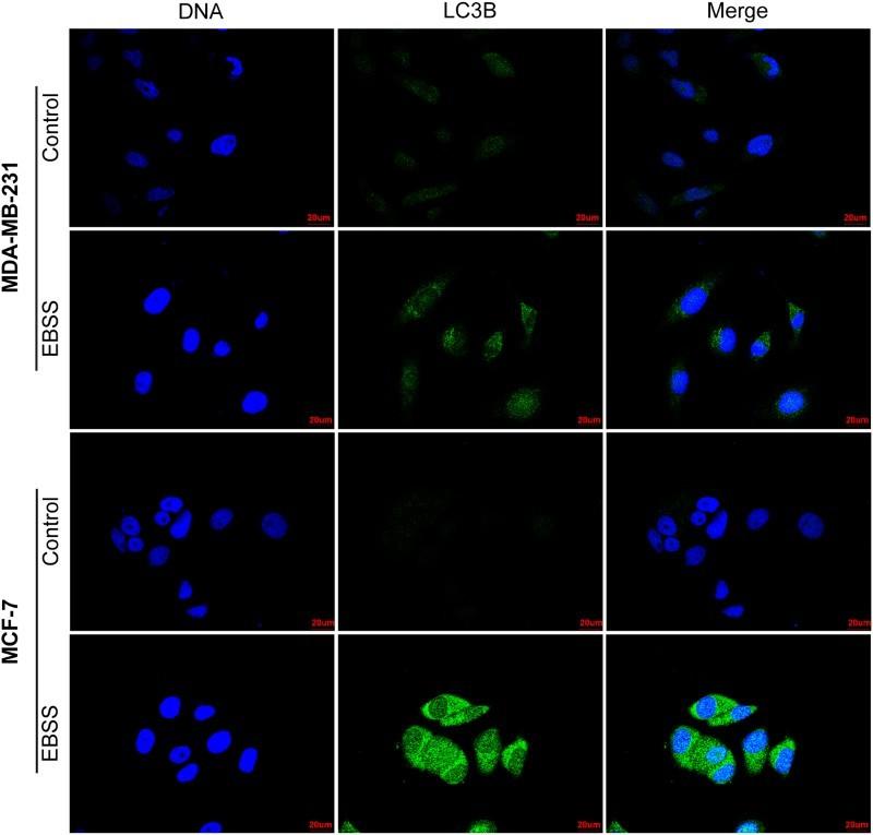 https://cdn.ncbi.nlm.nih.gov/pmc/blobs/01fb/6138357/14650eceeffb/TACS_A_1330763_F0002_C.jpg