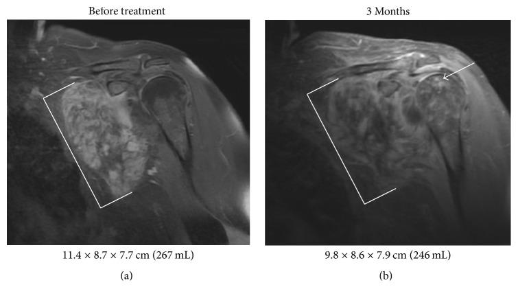 https://cdn.ncbi.nlm.nih.gov/pmc/blobs/020a/5516706/ea989c71e9c7/SARCOMA2017-2316839.002.jpg