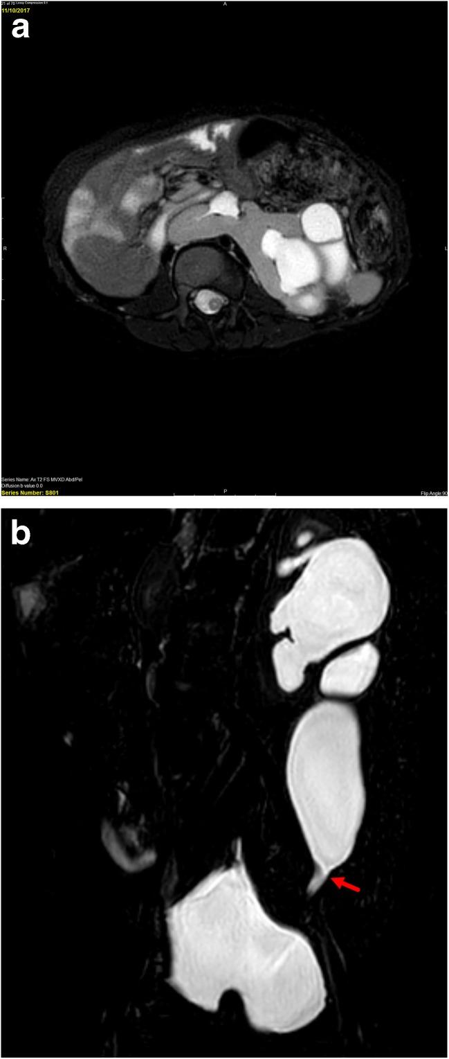 https://cdn.ncbi.nlm.nih.gov/pmc/blobs/020a/6132788/5b1a05e24783/11934_2018_843_Fig4_HTML.jpg