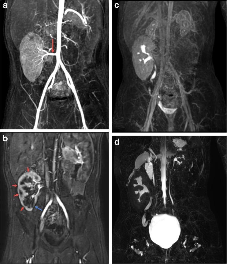 https://cdn.ncbi.nlm.nih.gov/pmc/blobs/020a/6132788/d2896b39af98/11934_2018_843_Fig8_HTML.jpg