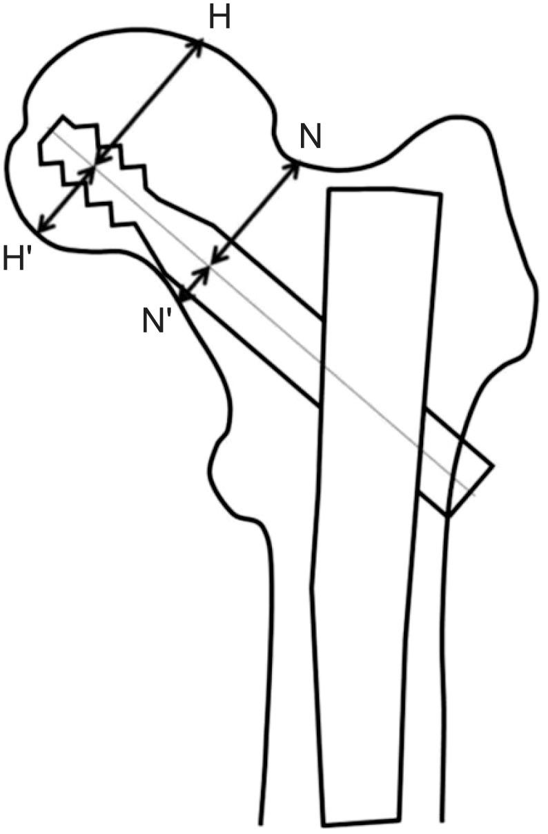 https://cdn.ncbi.nlm.nih.gov/pmc/blobs/0214/4553275/e4220530911a/cios-7-291-g004.jpg