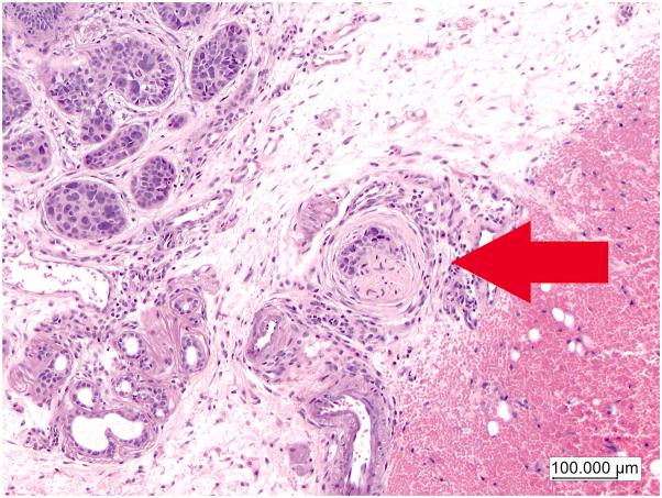 https://cdn.ncbi.nlm.nih.gov/pmc/blobs/021a/10869928/d48a304563f9/gr1.jpg