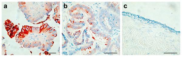 https://cdn.ncbi.nlm.nih.gov/pmc/blobs/0220/2770078/6f001ef95c8c/1471-2407-9-378-2.jpg