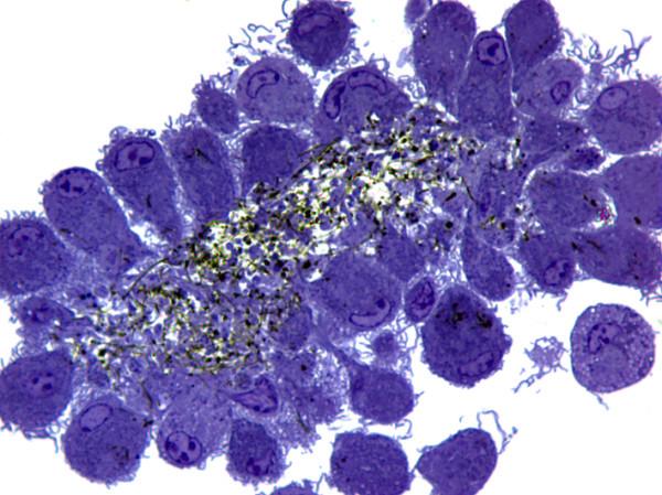 https://cdn.ncbi.nlm.nih.gov/pmc/blobs/0224/3120675/621ea13706ed/1743-8977-8-17-10.jpg