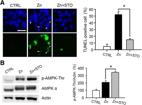 https://cdn.ncbi.nlm.nih.gov/pmc/blobs/022a/4746814/77211a9a196b/13041_2016_194_Fig4_HTML.jpg