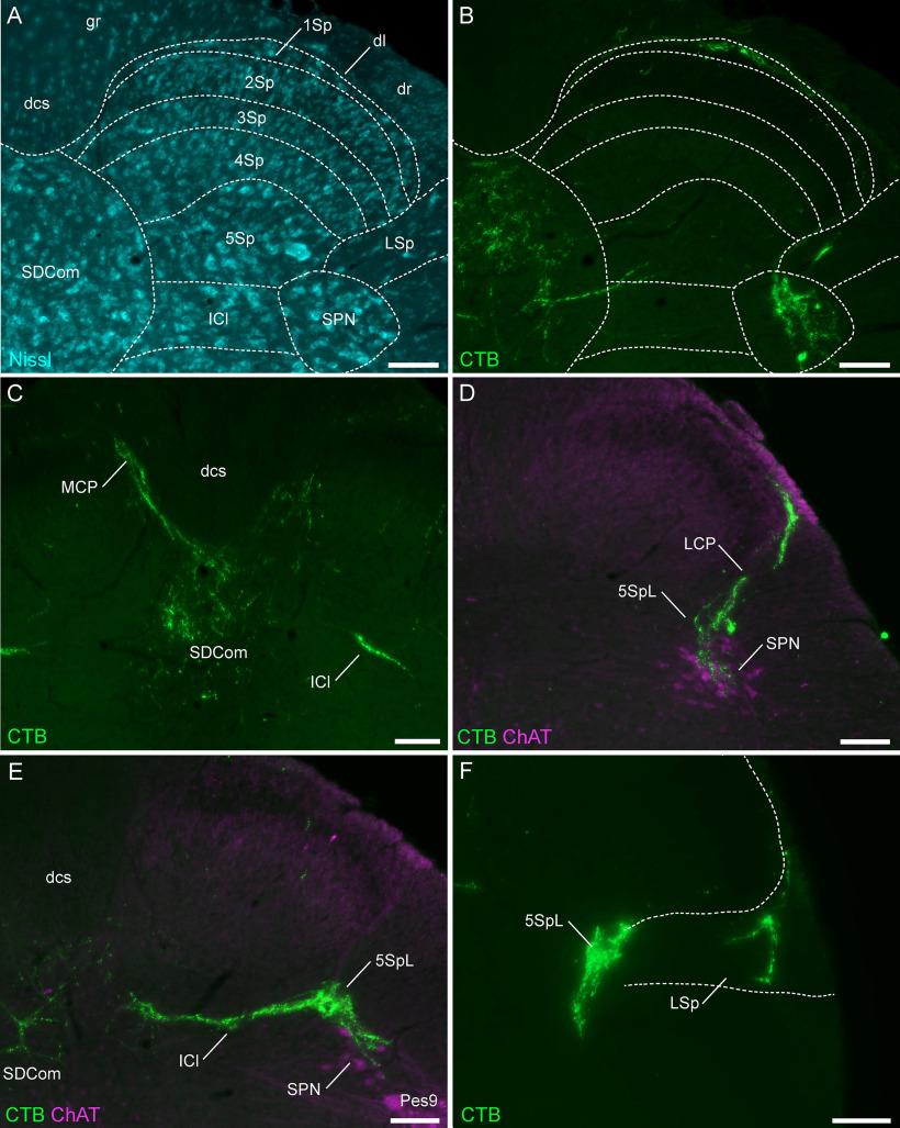 https://cdn.ncbi.nlm.nih.gov/pmc/blobs/0234/8690816/b2b2b1bf1d17/ENEURO.0364-21.2021_f002.jpg