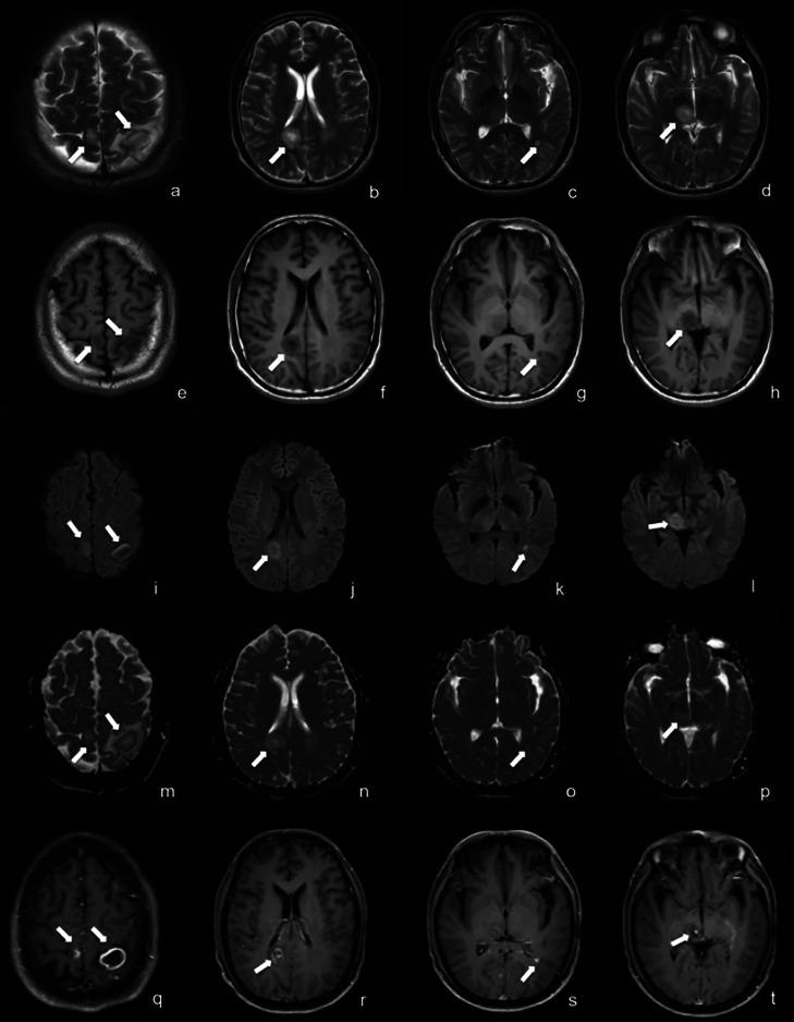 https://cdn.ncbi.nlm.nih.gov/pmc/blobs/023f/11964735/ff94a3982ceb/gr3.jpg