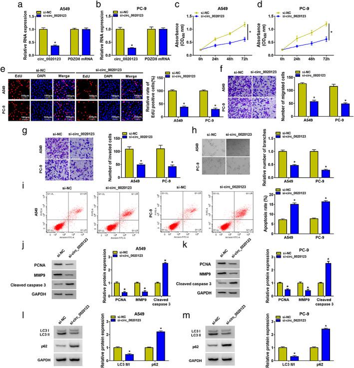 https://cdn.ncbi.nlm.nih.gov/pmc/blobs/0246/9058299/600851cbee79/TCA-13-1406-g006.jpg