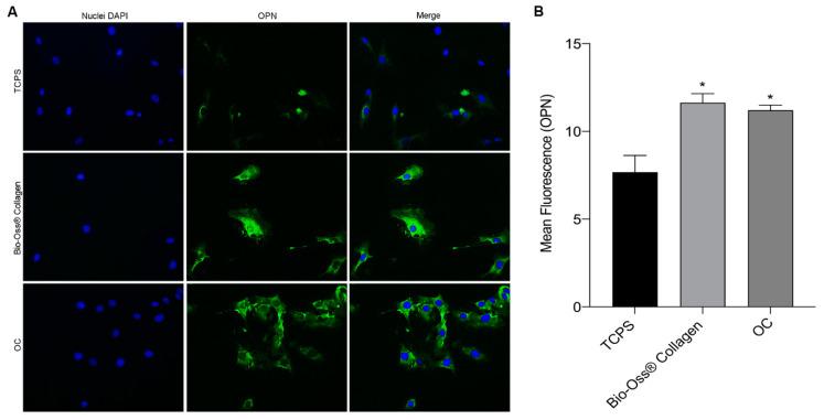 https://cdn.ncbi.nlm.nih.gov/pmc/blobs/0249/12027874/963d01fb39b3/ijms-26-03807-g004.jpg
