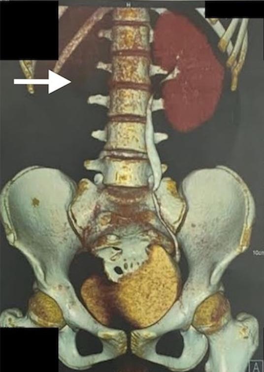 https://cdn.ncbi.nlm.nih.gov/pmc/blobs/0252/10792714/fddc10e00713/JNMA-61-268-949-g3.jpg