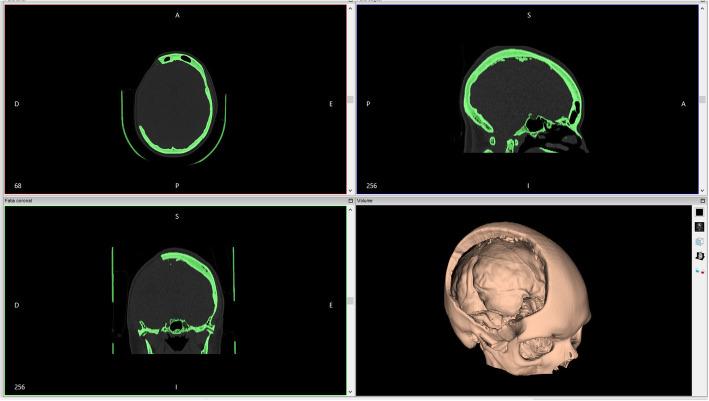 https://cdn.ncbi.nlm.nih.gov/pmc/blobs/025d/7866687/75776508f770/41205_2021_96_Fig1_HTML.jpg