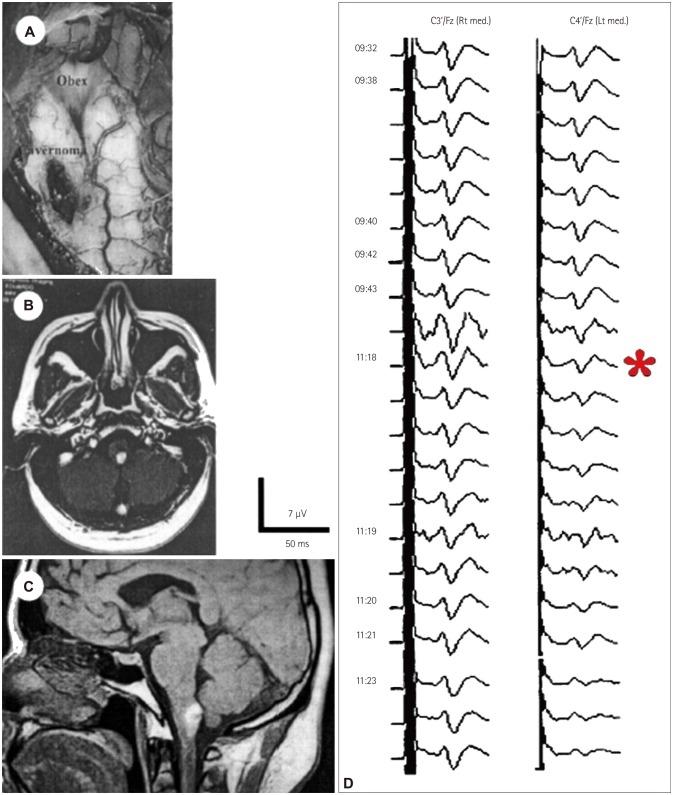 https://cdn.ncbi.nlm.nih.gov/pmc/blobs/0264/4960209/411a3e32969b/jcn-12-262-g004.jpg