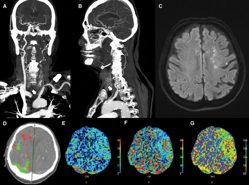 https://cdn.ncbi.nlm.nih.gov/pmc/blobs/0267/10174393/831db8fb1a50/medi-102-e33790-g002.jpg