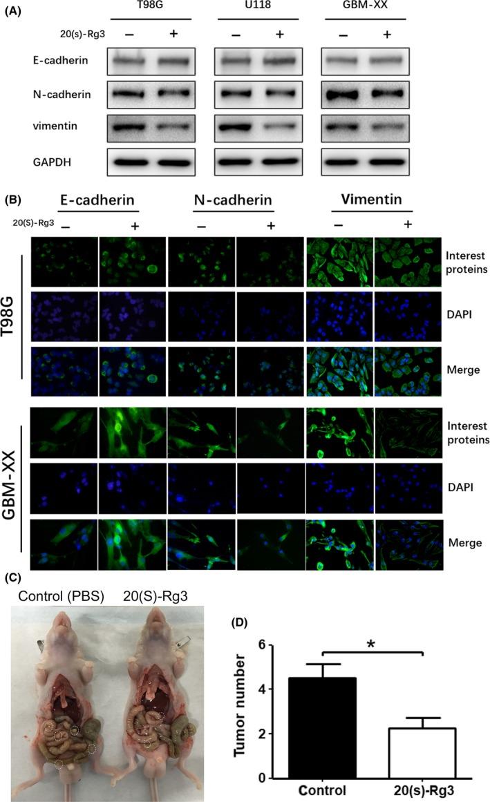 https://cdn.ncbi.nlm.nih.gov/pmc/blobs/0268/6317960/e399e417d3aa/CAS-110-389-g006.jpg