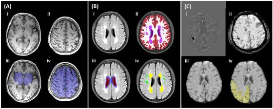 https://cdn.ncbi.nlm.nih.gov/pmc/blobs/026b/12010275/01e358c80c71/ALZ-21-e70196-g003.jpg