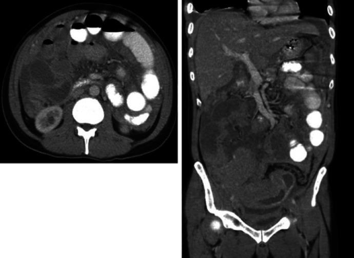 https://cdn.ncbi.nlm.nih.gov/pmc/blobs/026e/7506374/af40eb0cae82/cro-0013-0968-g01.jpg