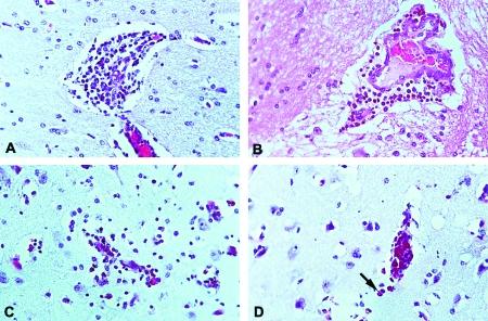 https://cdn.ncbi.nlm.nih.gov/pmc/blobs/0274/2901937/780b6c75ca24/02-0124-F6.jpg