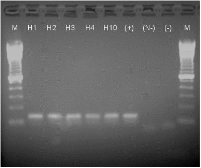https://cdn.ncbi.nlm.nih.gov/pmc/blobs/0274/2901937/856dc187926c/02-0124-F5.jpg