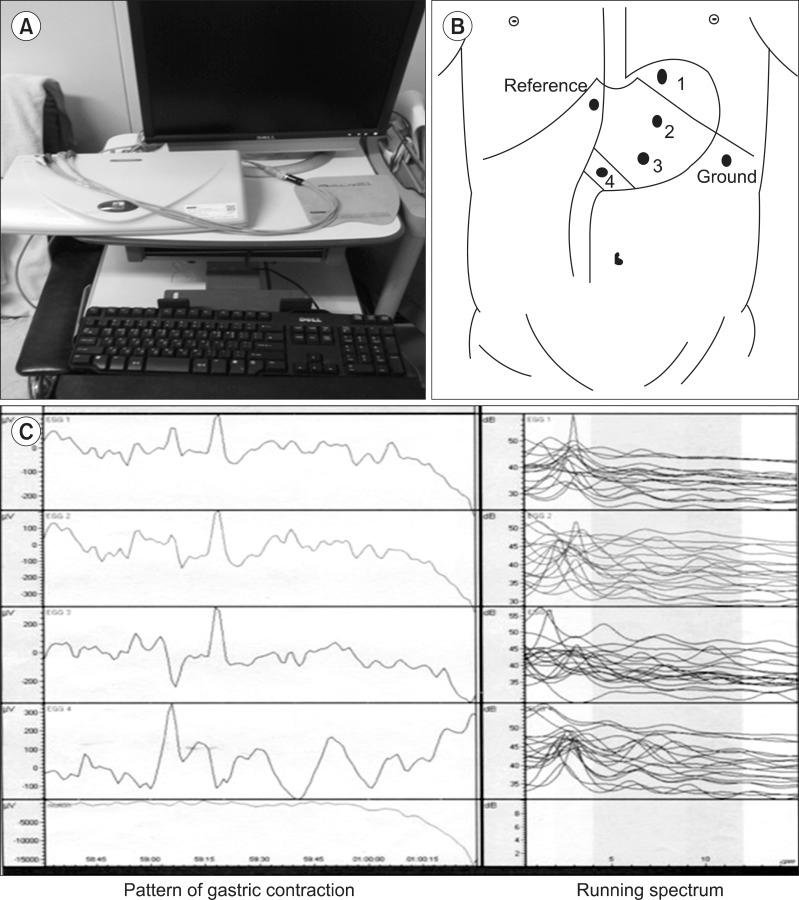 https://cdn.ncbi.nlm.nih.gov/pmc/blobs/027a/3996249/b6a67cae8948/jgc-14-47-g001.jpg