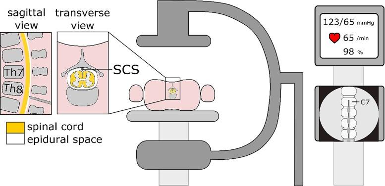 https://cdn.ncbi.nlm.nih.gov/pmc/blobs/027a/9825802/9488acf6dfe1/oeac083f8.jpg