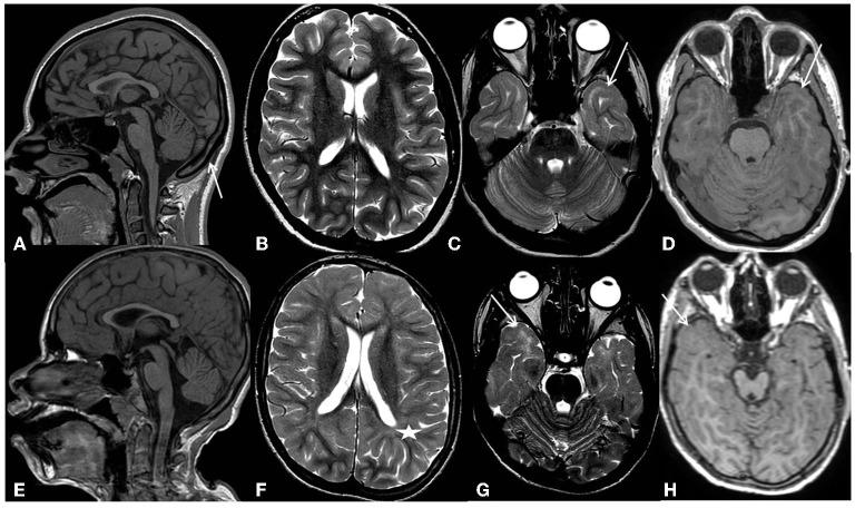 https://cdn.ncbi.nlm.nih.gov/pmc/blobs/027d/10359812/380264987bdb/fneur-14-1181015-g0001.jpg