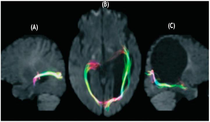 https://cdn.ncbi.nlm.nih.gov/pmc/blobs/027f/8533908/1955a9e4ef18/brainsci-11-01279-g001.jpg