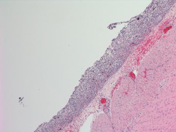 https://cdn.ncbi.nlm.nih.gov/pmc/blobs/0282/4756096/ec86abdf3e71/gr2.jpg
