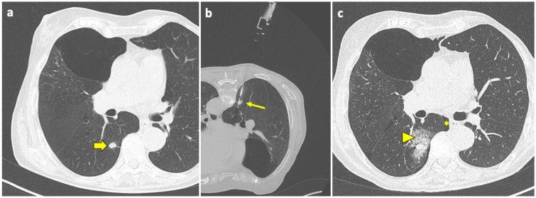 https://cdn.ncbi.nlm.nih.gov/pmc/blobs/0286/11171640/7a6ce8f3d7cf/diagnostics-14-01089-g003.jpg