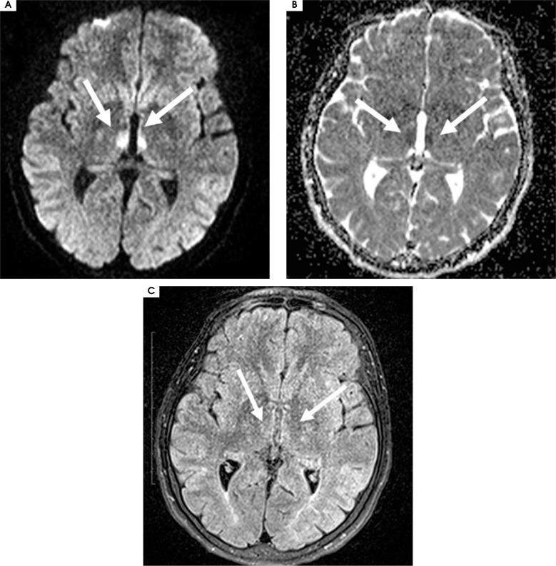 https://cdn.ncbi.nlm.nih.gov/pmc/blobs/0286/9881569/813e6cee7553/PPN-31-46771-g003.jpg